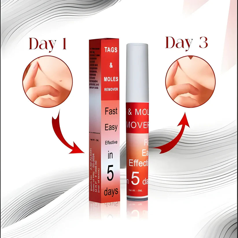 Skin Tag Remover Cream