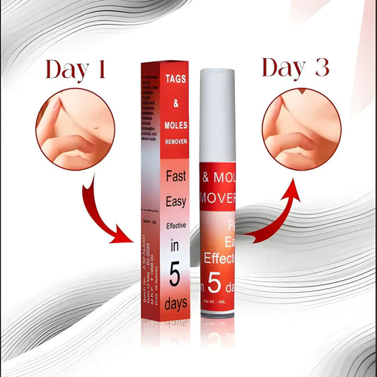 Skin Tag Remover Cream